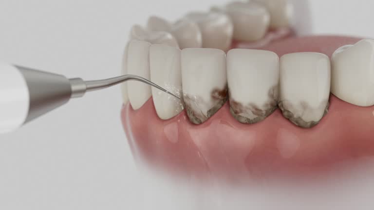 Trusted Teeth Cleaning And Checkup service in Beecher, IL - Dentist Open Now